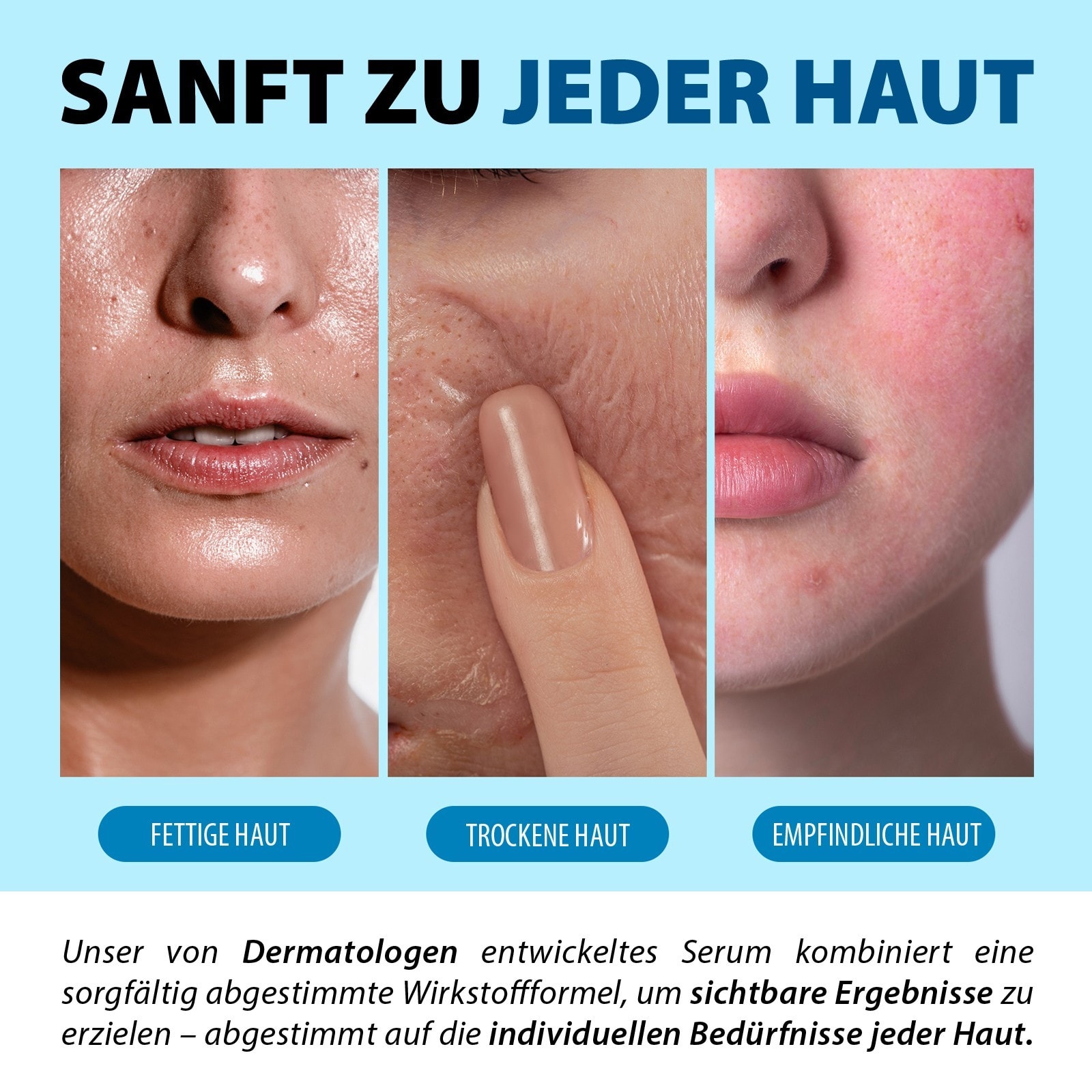Gesichtsserum Niacinamide Hyaluronsäure B3 10% Haut Face Serum Microneedling 30ml