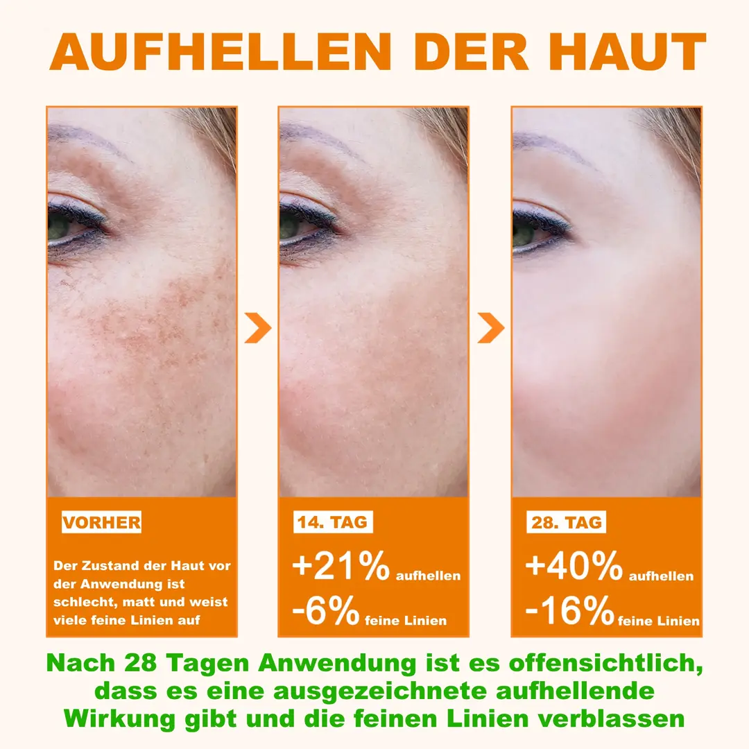 Vitamin C Gesichtsserum Mit Hyaluronsäure – 110 Ml, Anti-Falten, Aufhellend, Für Alle Hauttypen