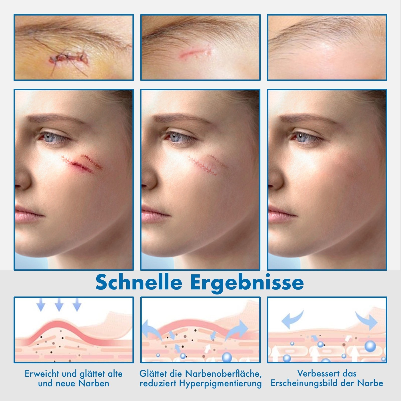 Narbenpflaster Silikonpflaster Transparent Narben Reduktion für Gesicht Körper