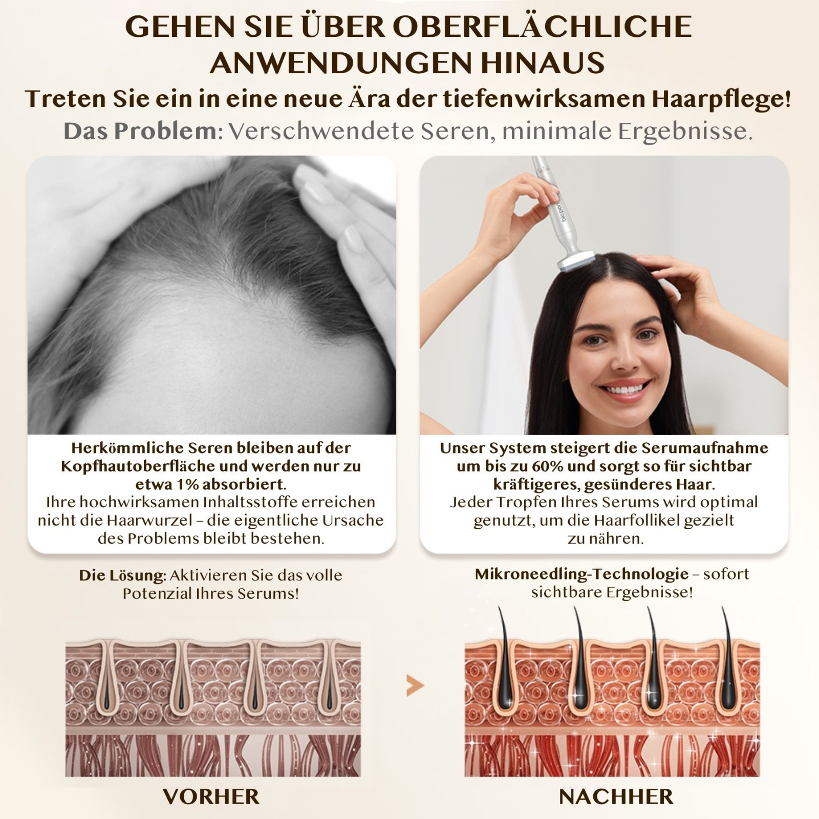Derma Stamp Mesoroller Microneedling Dermapenn  BIOPEN BIO4 2 Aufsätze Edelstall Nadeln 0-3mm