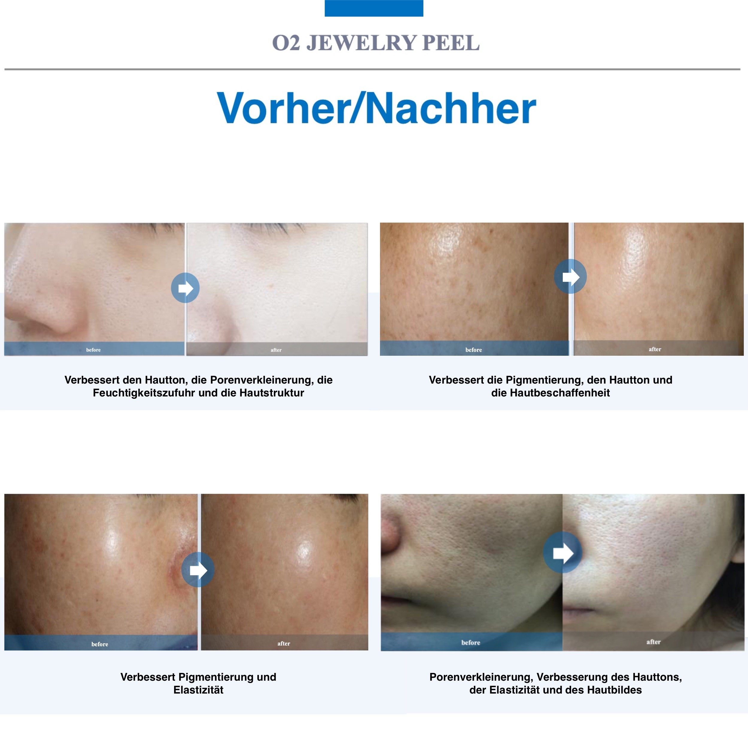 O2 JEWELRY PEEL