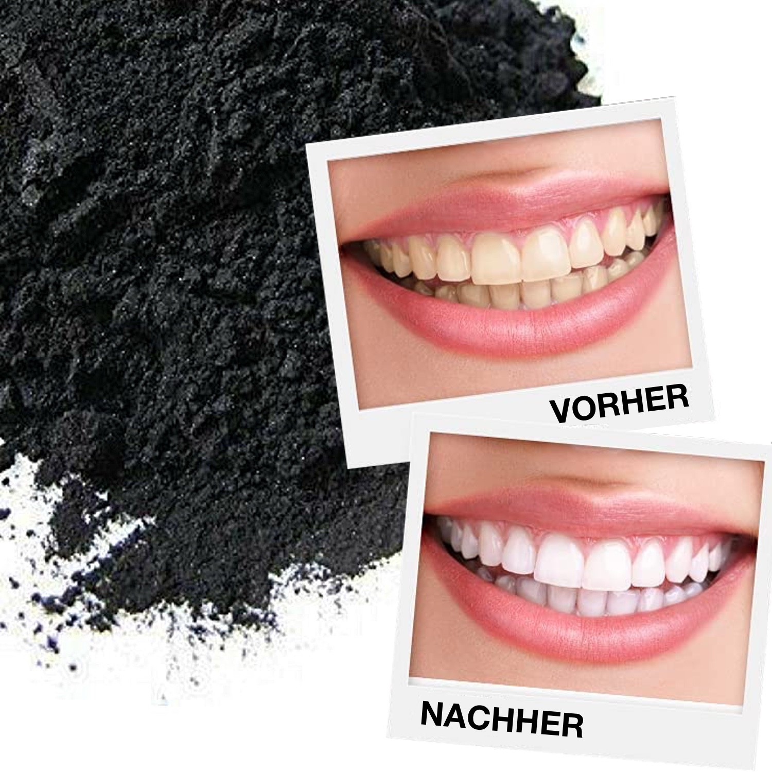 Hochwertiges Zahnaufhellung Set weißere Zähne dank Aktivkohle Technologie - für Zuhause und unterwegs | Bio | Teeth Whitening Bleichsystem