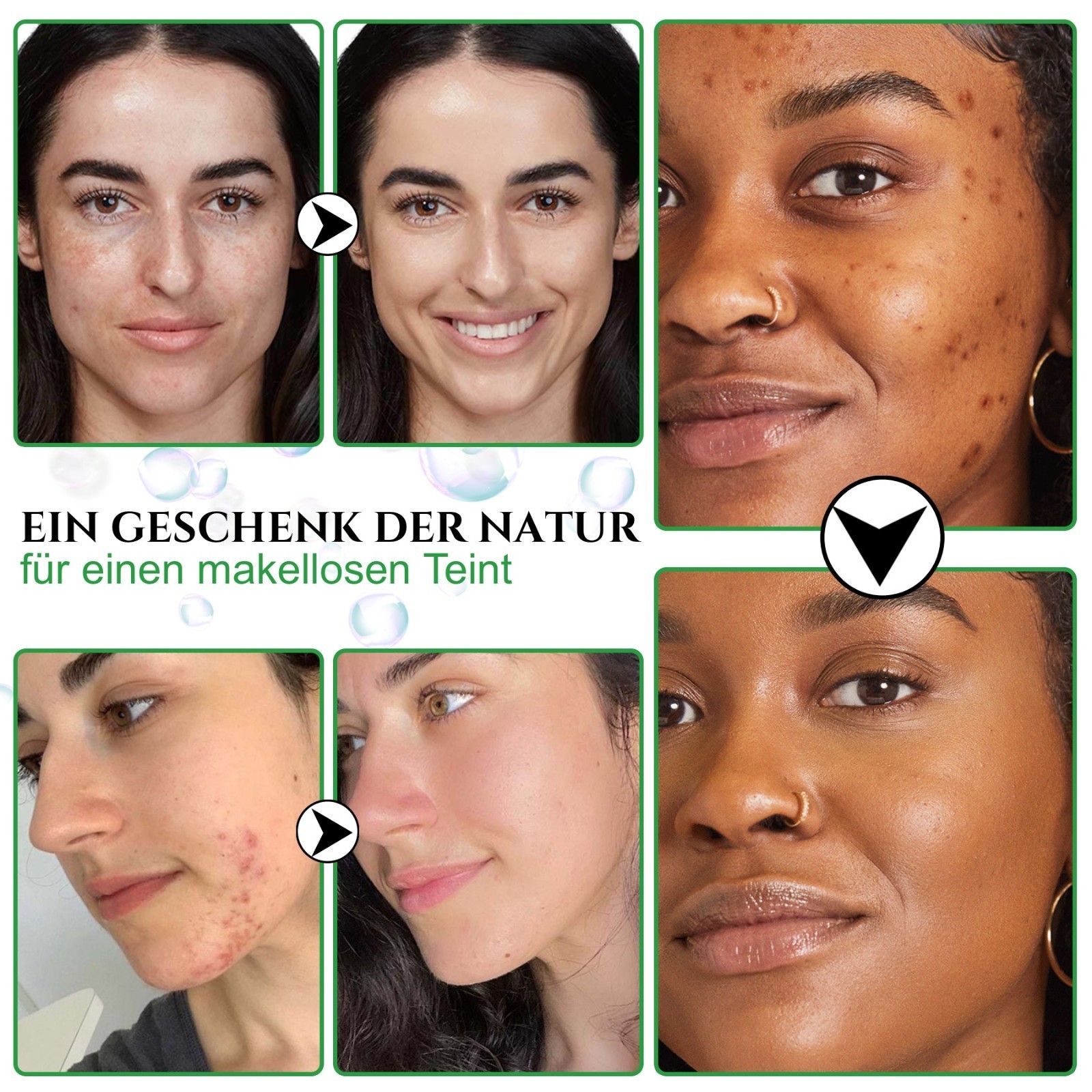 Gesichtsseife Körperseife Haarseife Naturseife Afrikanische Schwarze Seife Vegan