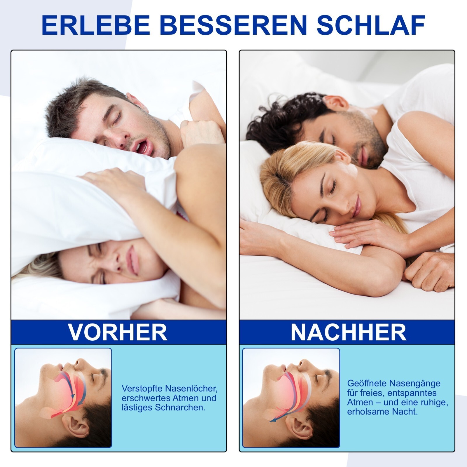 Magnetische Nasenstrip Nasenpflaster Schnarchreduzierung Schnarchstopp