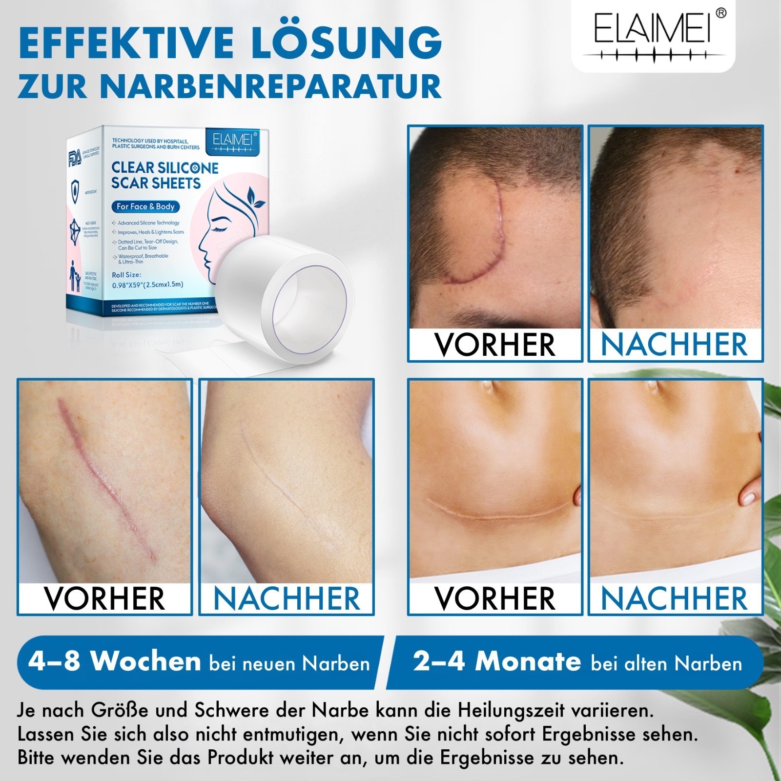 Narbenpflaster Silikonpflaster Transparent Narben Reduktion für Gesicht Körper