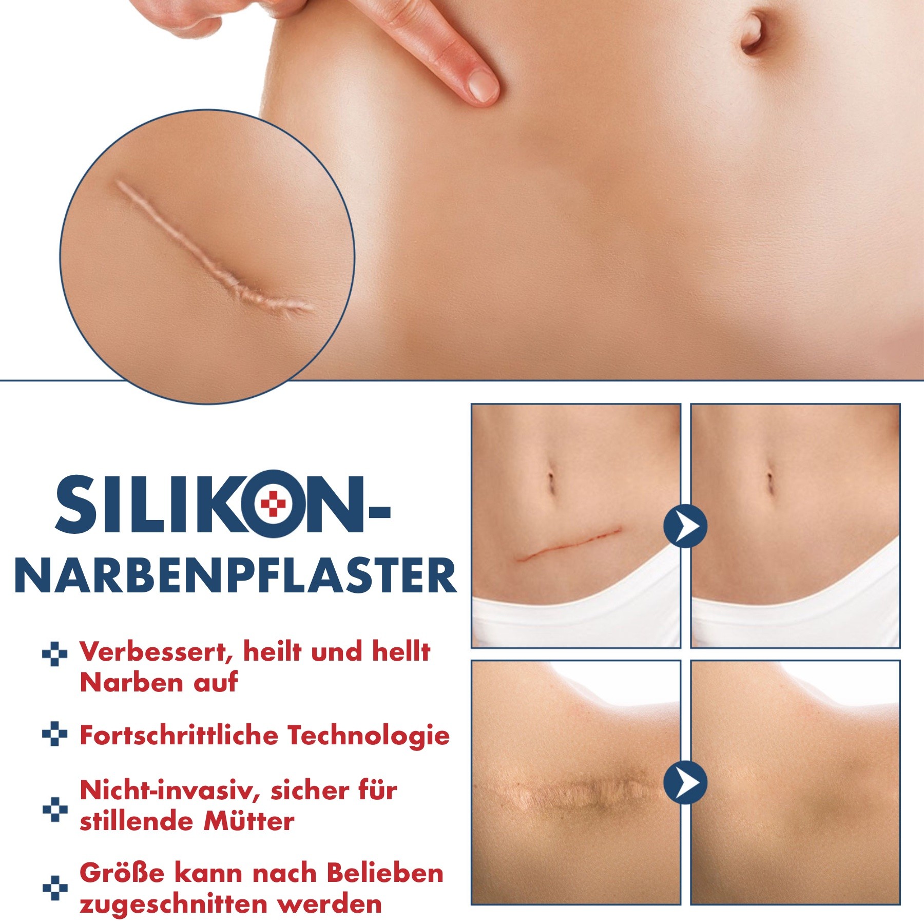 Silikonpflaster Narben Reduktion 