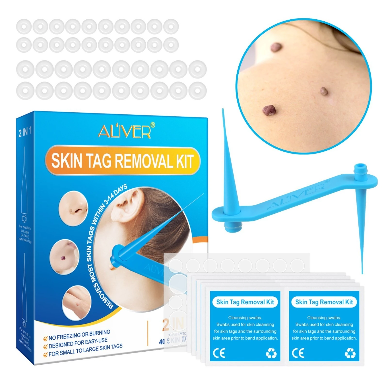 Warzenentferner Skin Tag Removal Set 2-in-1