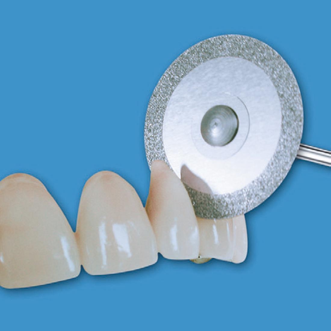 EDENTA | ED-365.524.300HP - Disque diamanté FLEX