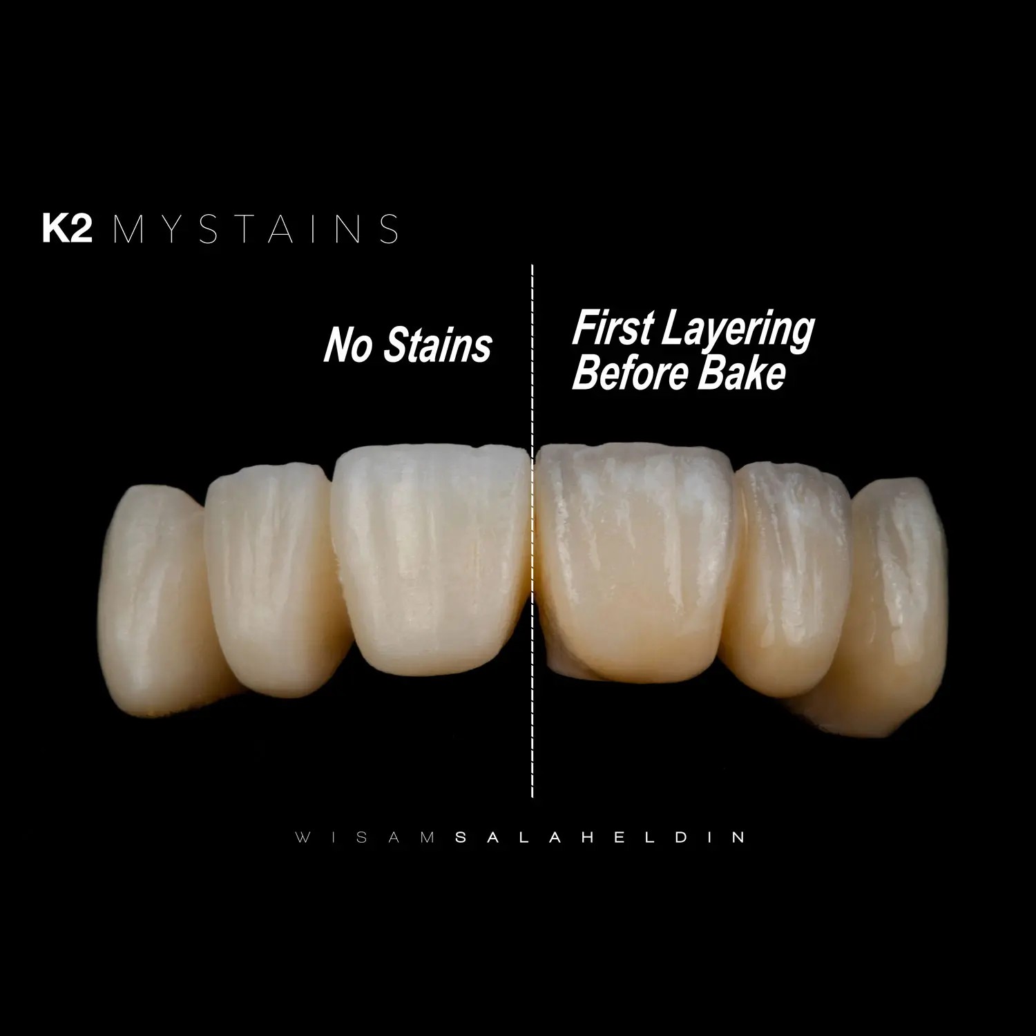 K2 MyStains Structure Set