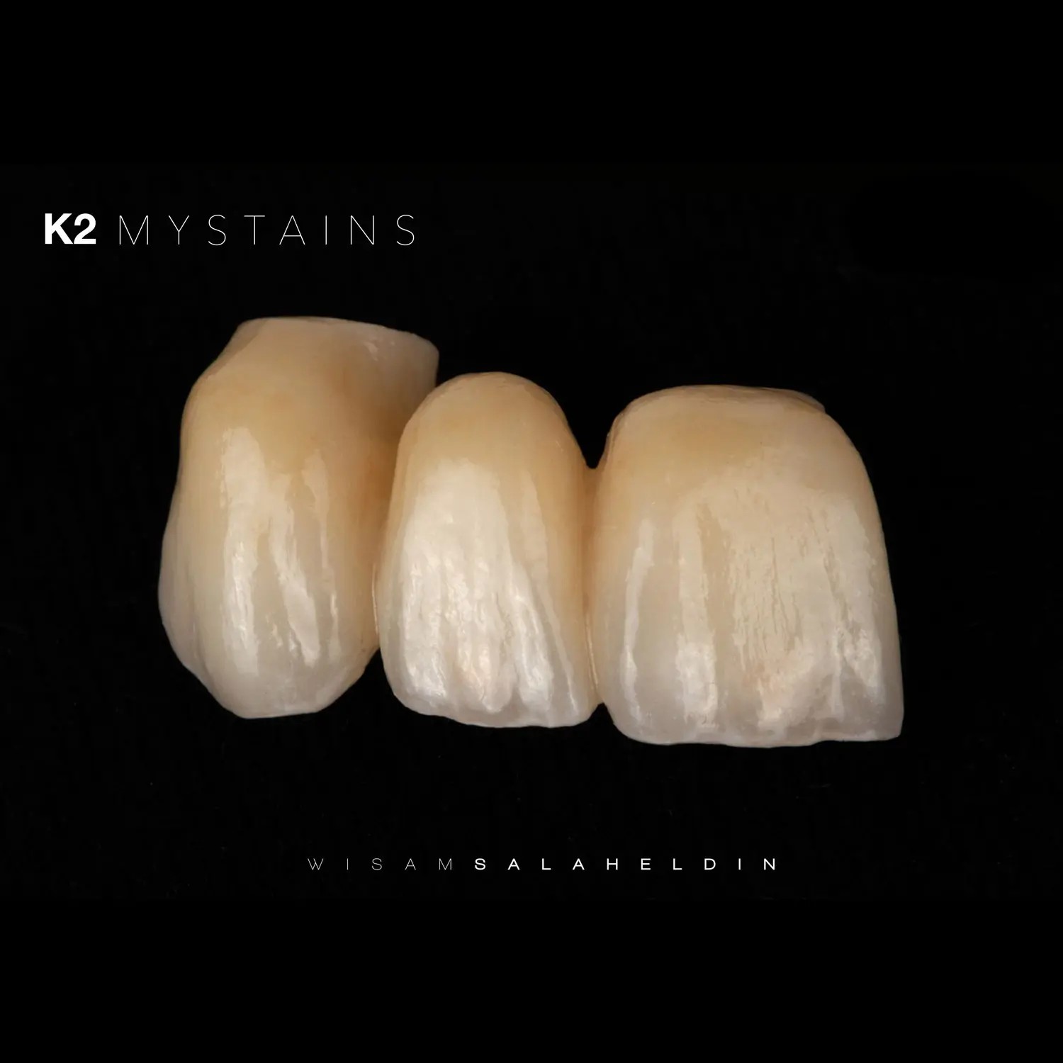 K2 MyStains Structure Set