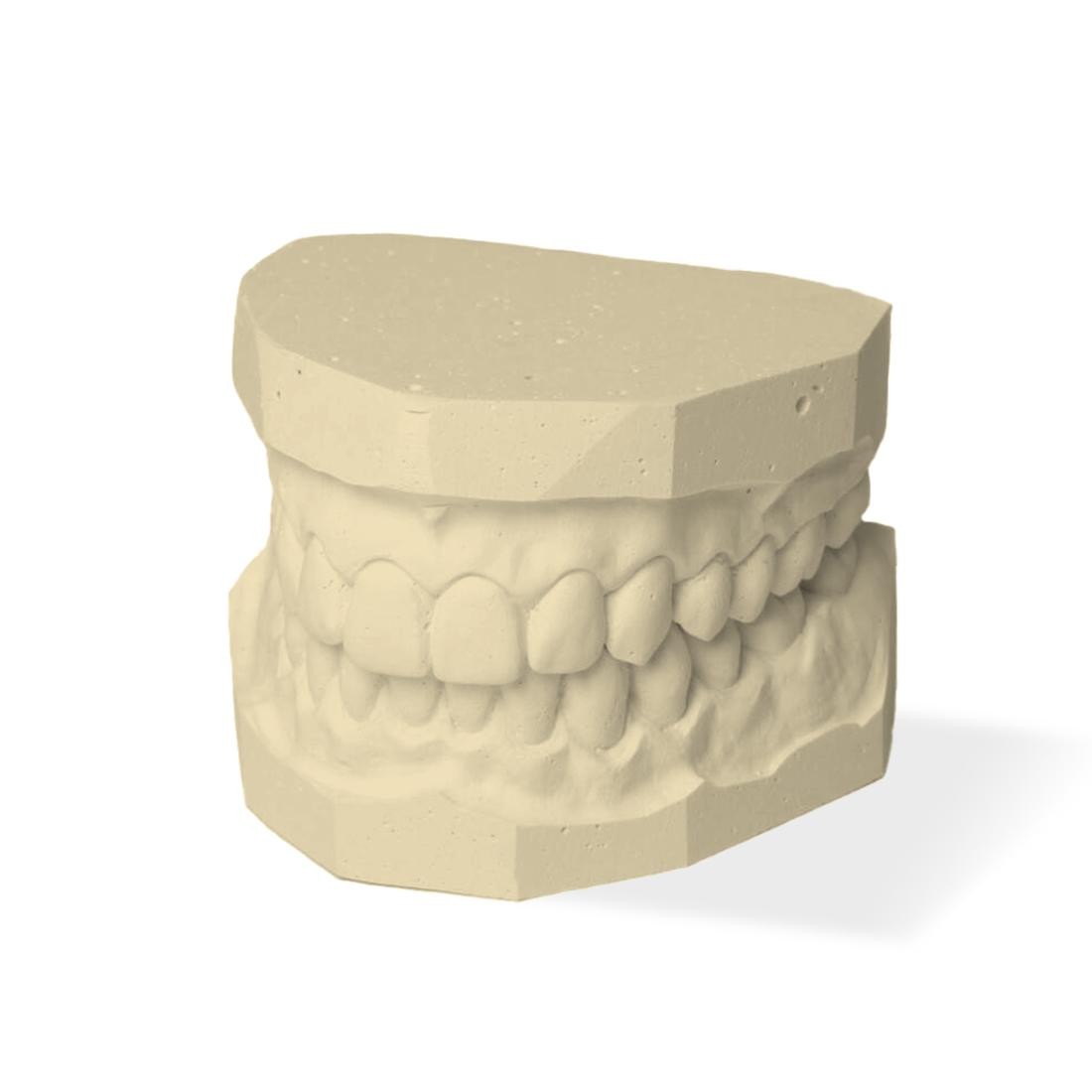 Denturaix | Plâtre Classe type 4